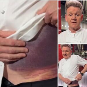 Gordon Ramsay shares important message after potentially fatal accident Gordon Ramsay shares important message after potentially fatal accident